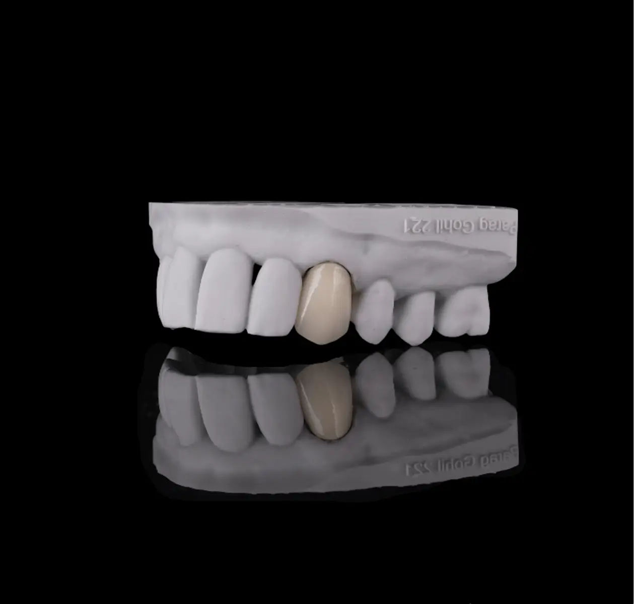 Dental Implants