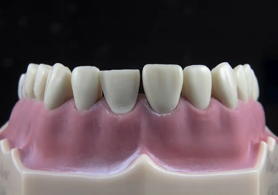 Large gaps between teeth