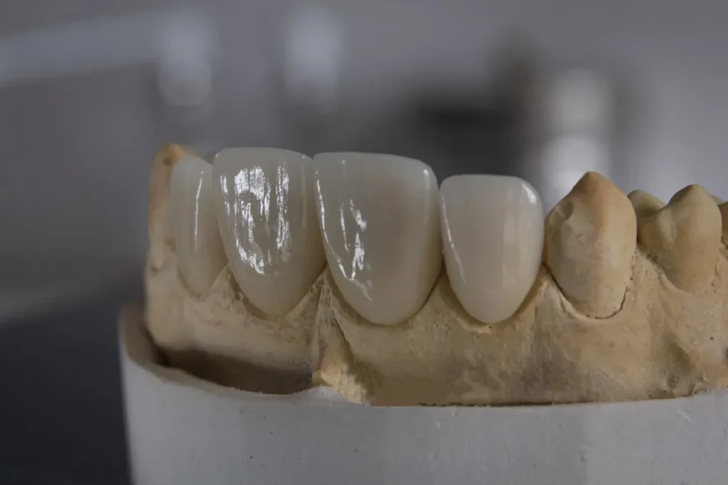 Persistent Discolouration