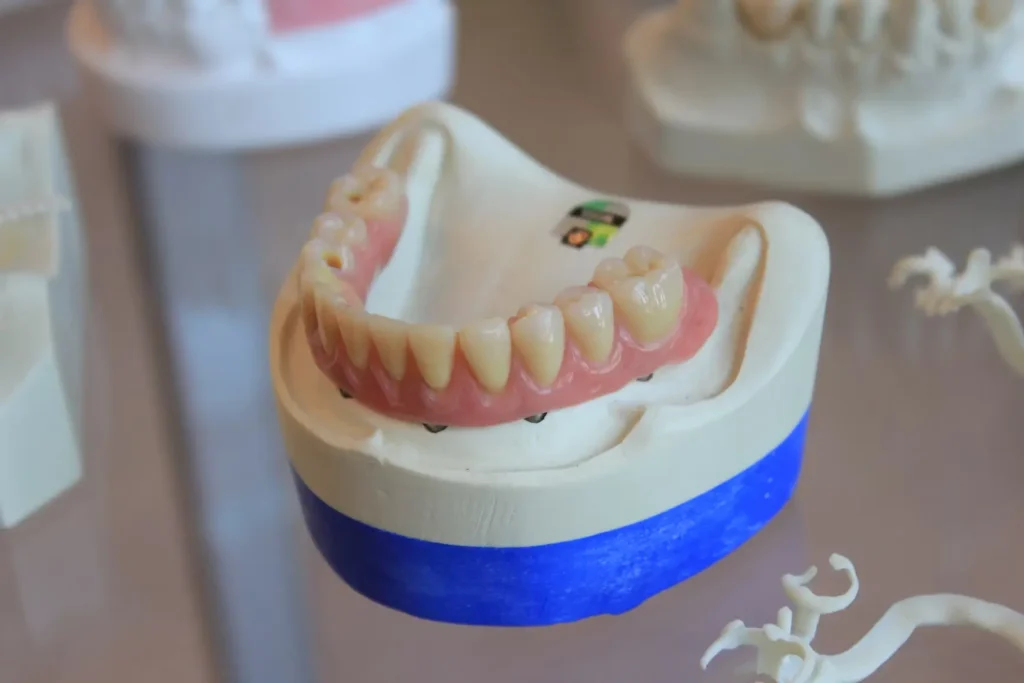 Porcelain dental crowns